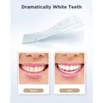 Fairywill Deliciated Teeth Whitening Strips