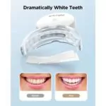Fairywill-Super-Whitening-Strips-With-Enhanced-Light-28-Strips